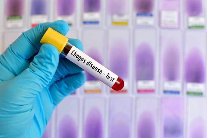 Chagas disease could be endemic in US, warns CDC