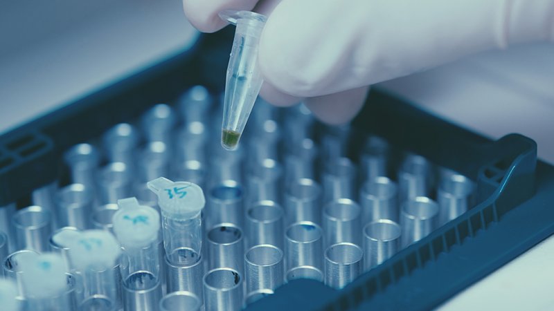 Australian scientists identify new bat-borne virus