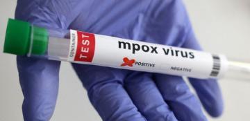 Japan confirms first case of Clade 1b mpox virus in Kobe 