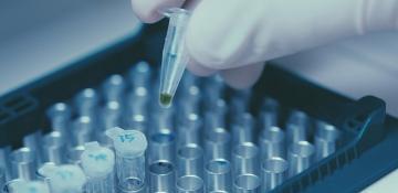 Australian scientists identify new bat-borne virus