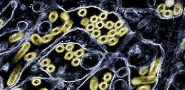 First U.S. human bird flu case in 9 months confirmed with animal-only strain