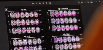 Novo Nordisk Alzheimer's drug trial fails to meet main goal, shares drop 10% 