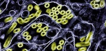 1st human case of H5N5 bird flu reported; Washington patient dies 