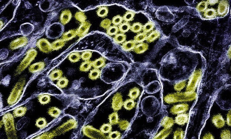 1st human case of H5N5 bird flu reported; Washington patient dies 