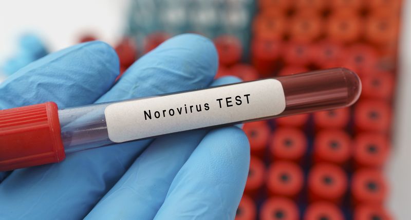 Norovirus cases rise across Los Angeles County