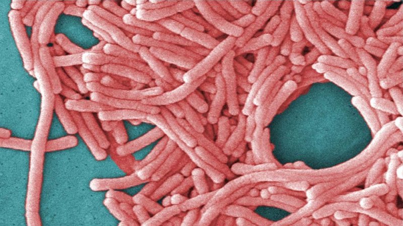 Sydney health alert after Legionnaires’ disease cluster grows
