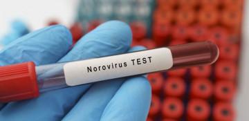 Norovirus cases rise across Los Angeles County