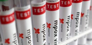 Mpox no longer a continental emergency in Africa