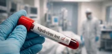 Experts warn but calm fears over India’s Nipah outbreak