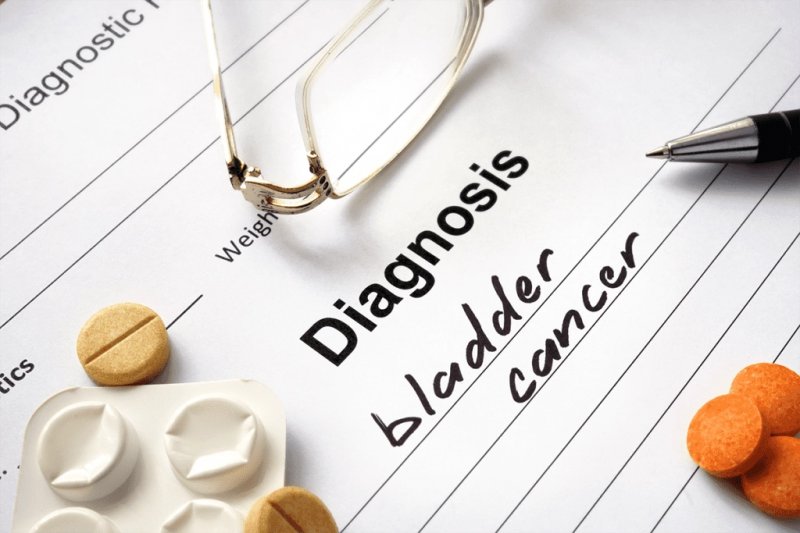 Colorblindness may hide crucial bladder cancer symptoms - Stanford study