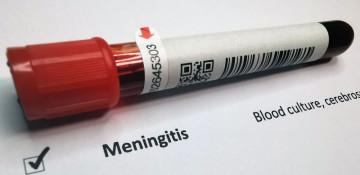 Two dead, 11 critically ill in Kent, UK meningitis outbreak