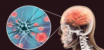 UK races to control meningitis outbreak after two fatalities