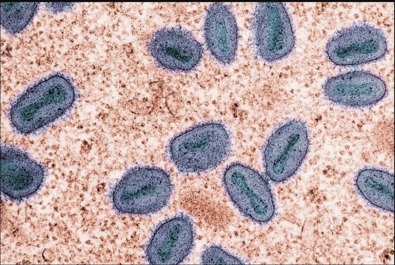 First community mpox cases confirmed in Singapore