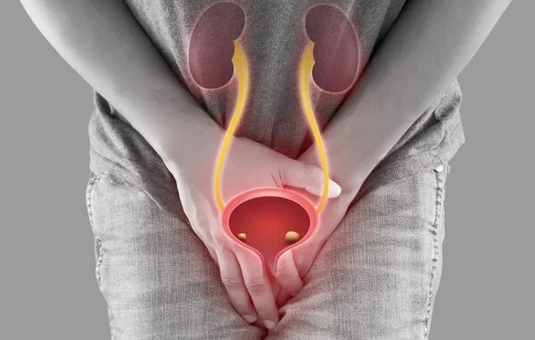 The chronic approach to stopping bladder cancer recurrence