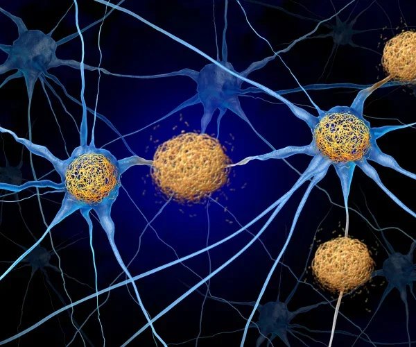 Vitamin B3 derivative could hold the key to preventing Alzheimer’s