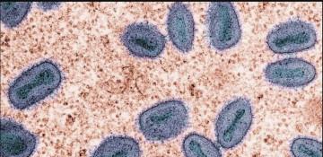 First community mpox cases confirmed in Singapore