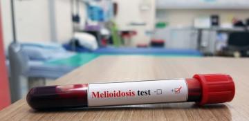 Thailand alerts public as melioidosis cases grow
