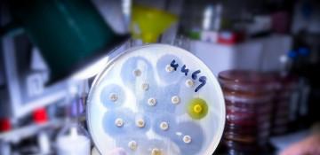 Scientists find key protein that could slow the spread of antibiotic resistance 