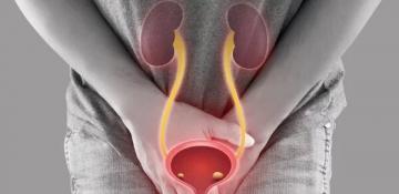 The chronic approach to stopping bladder cancer recurrence