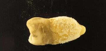 700-year-old tooth reveals 