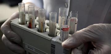 New Hepatitis B infections drop 32% globally