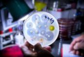 Scientists find key protein that could slow the spread of antibiotic resistance 