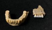 100,000-year-old teeth reveal secrets of Neanderthal migration across Europe