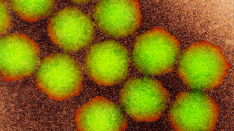 Polio strain detected in Australia's Perth for first time in 54 years