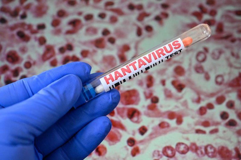 Wales monitors residents linked to rare hantavirus outbreak