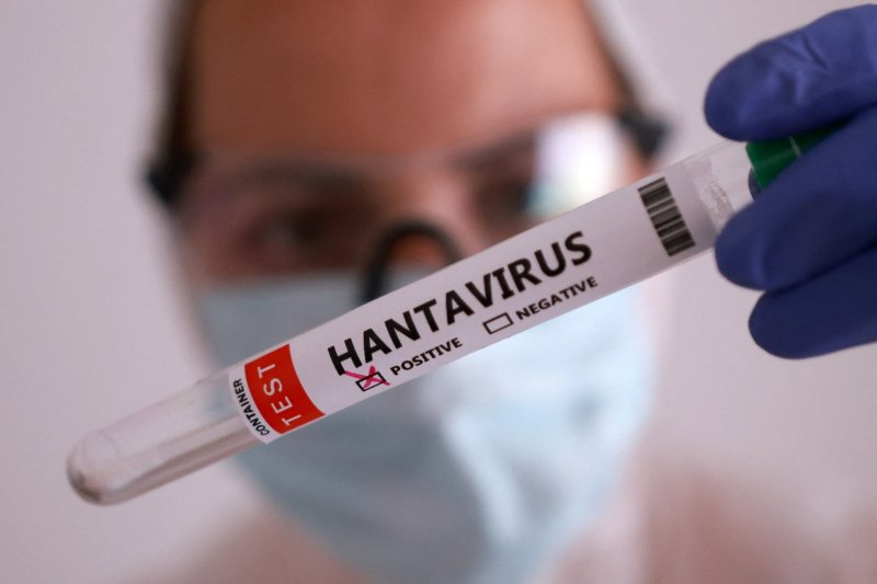 Canada monitors 30 people over suspected hantavirus exposure