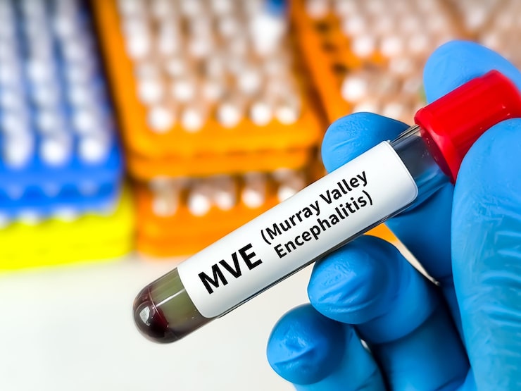 Two dead from rare mosquito-borne virus in Australia’s Northern Territory