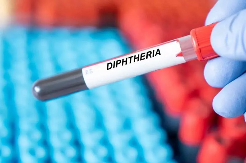 Australia records second diphtheria death