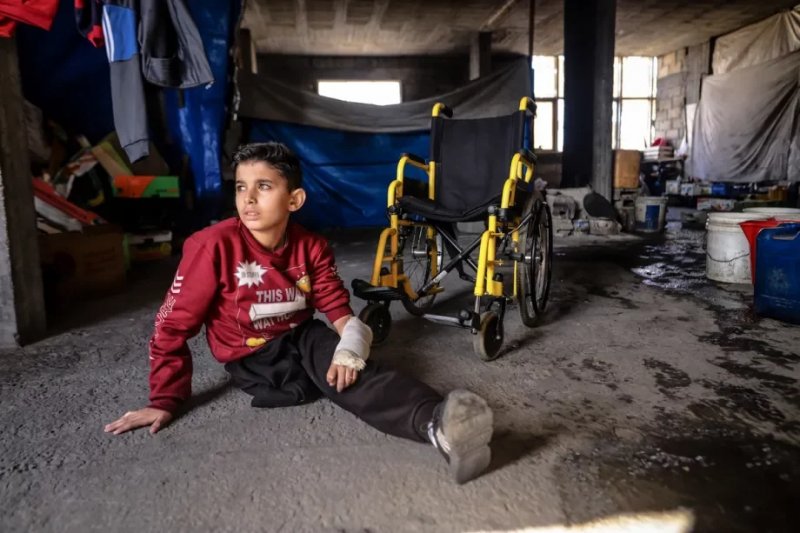 UN warns of prosthetic crisis in Gaza as one in five amputees is a child