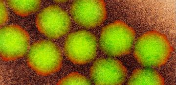 Polio strain detected in Australia's Perth for first time in 54 years