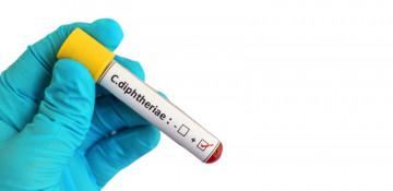 Australia records first diphtheria death in nearly a decade