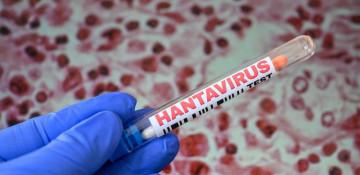 Wales monitors residents linked to rare hantavirus outbreak