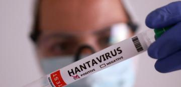 Canada monitors 30 people over suspected hantavirus exposure