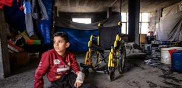 UN warns of prosthetic crisis in Gaza as one in five amputees is a child