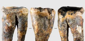 Neanderthals drilled tooth to treat cavity, study finds