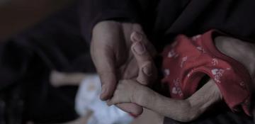 Doctors Without Borders warns of lasting harm to Gaza babies from malnutrition