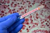 France reports no symptoms in 26 hantavirus contacts