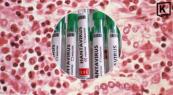 Why did Thailand classify hantavirus as a dangerous communicable disease?