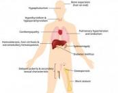 Study links Thalassemia to increased risk of reduced muscle function