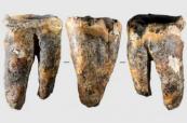 Neanderthals drilled tooth to treat cavity, study finds