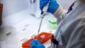WHO says cruise hantavirus outbreak risk is low