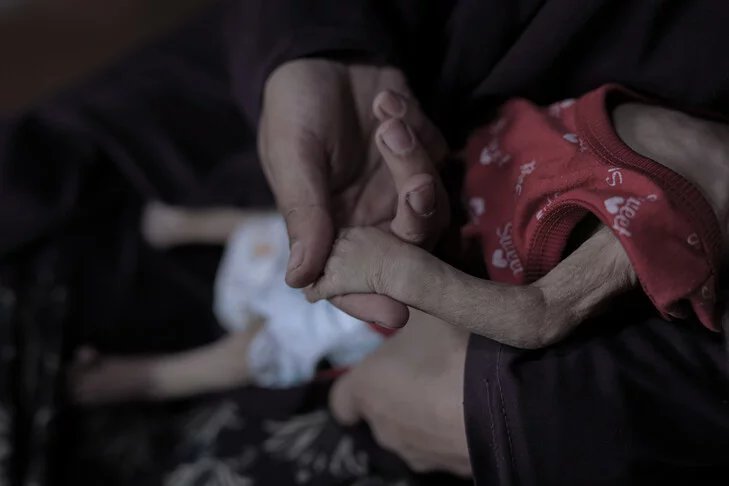 Doctors Without Borders warns of lasting harm to Gaza babies from malnutrition