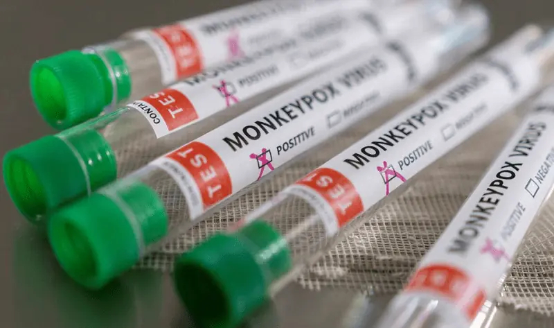 Monkeypox case confirmed in Karachi raises fears of local transmission in Pakistan