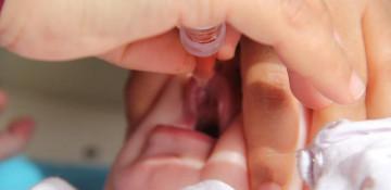 Two children die of measles in England as cases spike