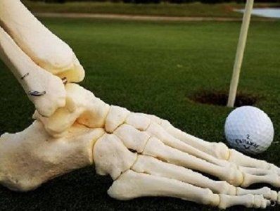 Amputated foot has its own Instagram account