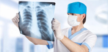 Number of tuberculosis patients decreased in Azerbaijan
